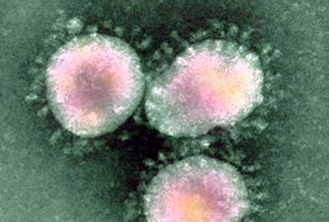 Remdésivir semble être efficace contre le coronavirus 