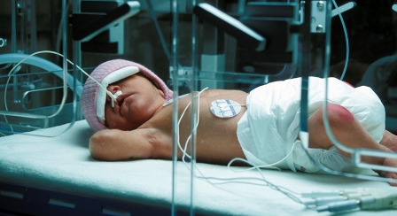 Tunisie – Décès des onze nourrissons : Le drame était prévisible selon une étude clinique datant de 2015