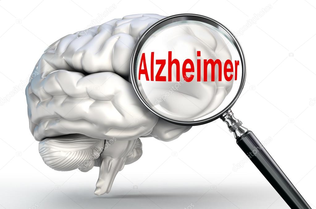Tunisie-Le nombre de personnes souffrantes d’Alzheimer a doublé entre 2012 et 2018