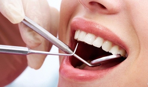 Tunisie: Augmentation des tarifs des dentistes, explications du syndicat des dentistes