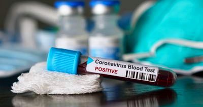 Coronavirus : L’épidémie connait un virage crucial