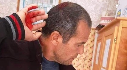 Tunisie – Gafsa : Des parents d’élèves agressent le directeur d’une école primaire