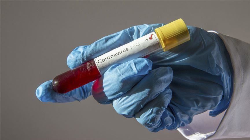 Coronavirus : Un médecin testé positif, au gouvernorat de Kasserine