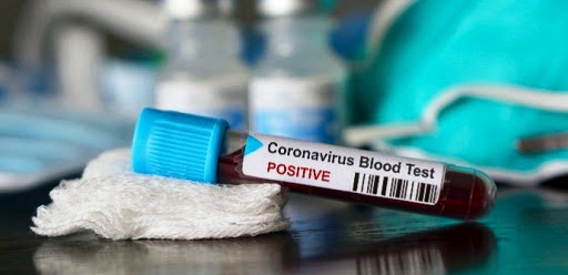 Coronavirus : Trois cas testés positifs à la Manouba, dont un à l’hôpital Razi