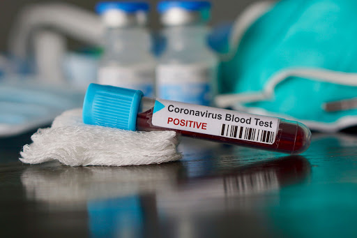 Coronavirus : Un cas confirmé à Msaken