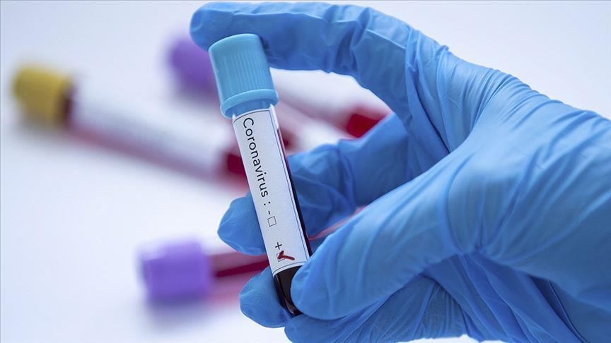 Coronavirus : Tous les gardes-frontières à Chebika ont effectué des tests de dépistage