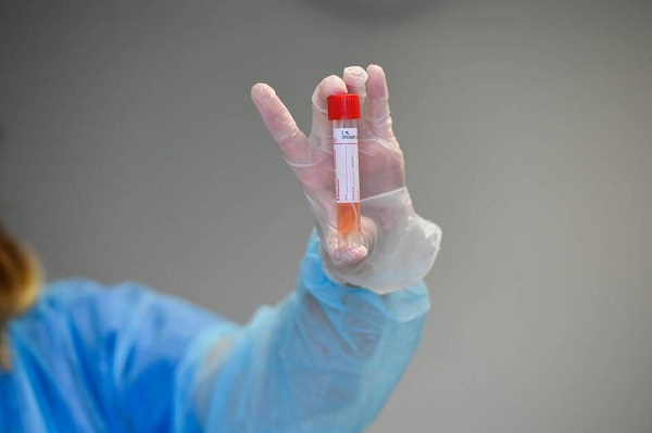 Coronavirus : 8274 tests de dépistage depuis le début de la crise sanitaire