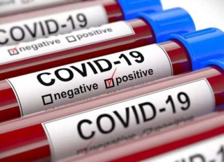 Coronavirus : 12.415 tests effectués jusqu’à la date du 14 avril
