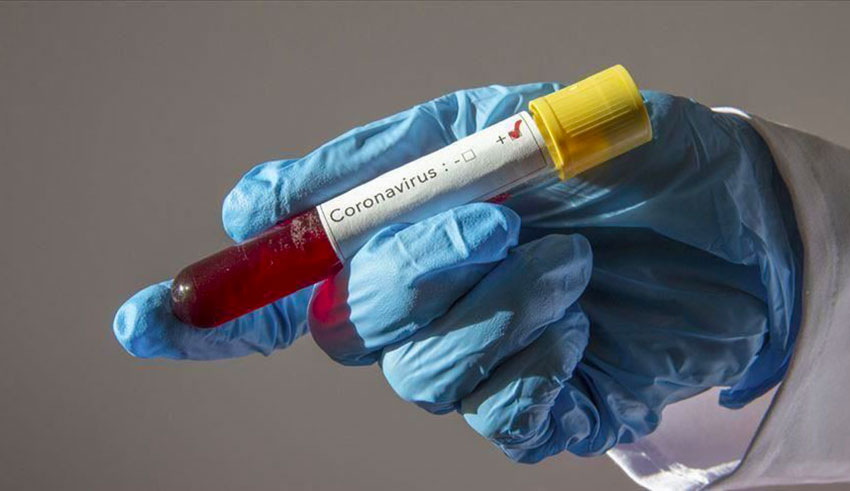 Coronavirus : Un nouveau cas importé à Mahdia