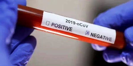 Coronavirus : Seulement, 116 personnes sont encore porteuses du virus