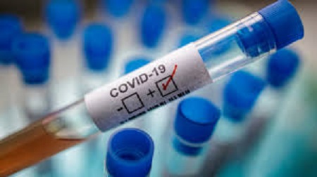 Coronavirus : Depuis le début de la crise sanitaire, 54.150 analyses de dépistage ont été effectuées