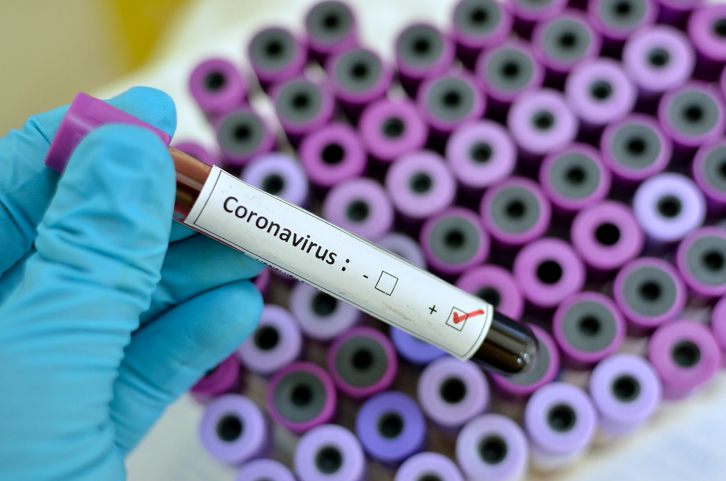 France : Plus de 1000 nouvelles contaminations au coronavirus en 24h