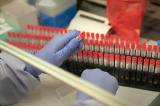Tunisie: La liste des laboratoires privés autorisés à réaliser le test RT-PCR