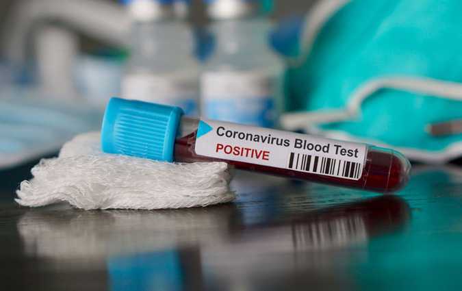 Libye: 801 nouvelles infections au coronavirus