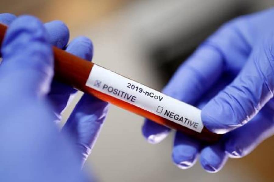 Coronavirus: 18 nouvelles contaminations au Kef