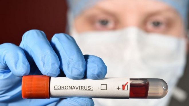 Coronavirus: Le port du masque éviterait certaines complications liées à la maladie