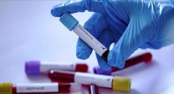Tunisie : Le directeur de la santé militaire révèle le nombre d’analyses effectuées dans le laboratoire militaire mobile