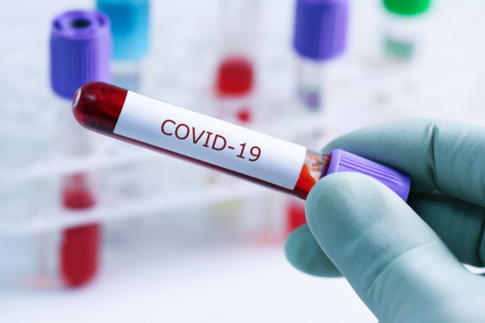 Tunisie: Un patient succombe à la Covid-19 et 44 nouvelles infections à Gafsa