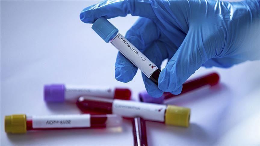 Coronavirus : 32 nouvelles contaminations et 2 nouveaux décès à Mahdia