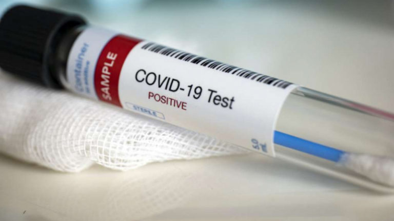 Coronavirus: 172 nouvelles contaminations et un décès à l’Ariana