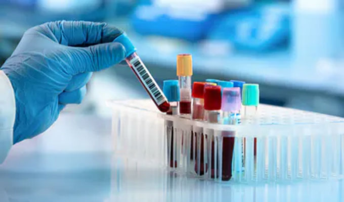 Tunisie : Hechmi Louzir : “Outre les tests PCR on utilisera les tests rapides qui détectent l’antigène du virus”
