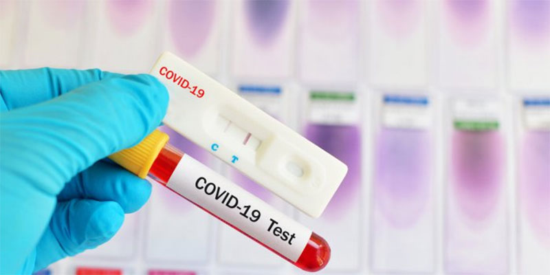 Tunisie: Utilisation publique des tests rapides du coronavirus à partir de ce lundi