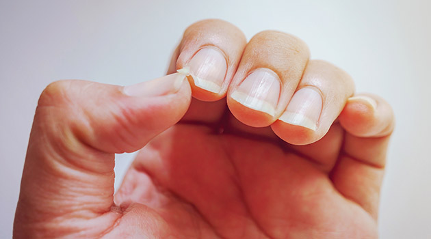 TN beauté : Ongles cassants ? Voici 3 astuces naturelles pour remédier à ce problème