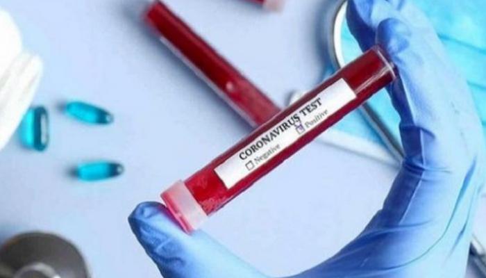 Coronavirus : 2 décès et 98 nouvelles contaminations à Kebili