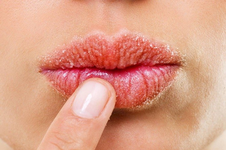 TN Beauté : Quel remède contre les lèvres sèches ?