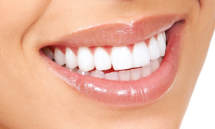 TN Beauté : 3 astuces naturelles pour avoir les dents blanches
