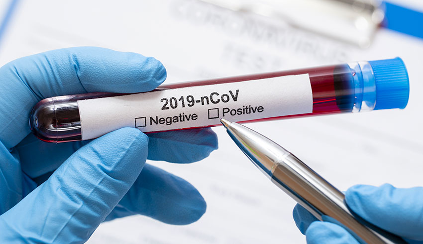 Coronavirus : Plus de 30% des tests réalisés sont positifs