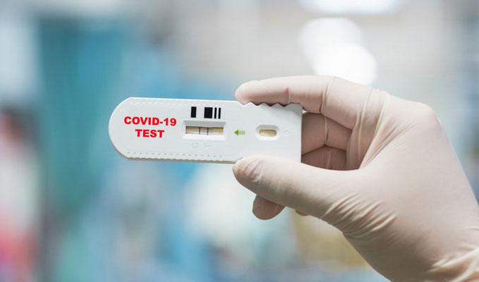 Tunisie-Coronavirus: Les tests rapides disponibles en pharmacies à partir d’aujourd’hui