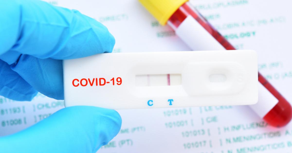 Coronavirus- Les chiffres annoncés ne reflètent pas la réalité: Un responsable explique [Audio]