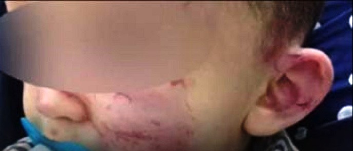 Tunisie – Agression d’un enfant dans une crèche : Fermeture de l’établissement et arrestation de la propriétaire