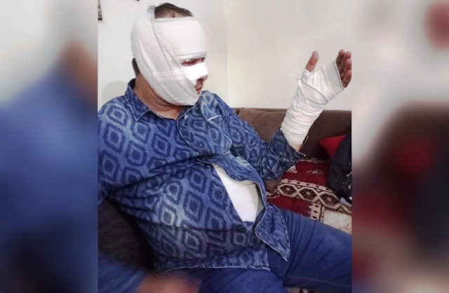 Tunisie – El Mourouj : Un policier gravement brûlé lors d’une arrestation