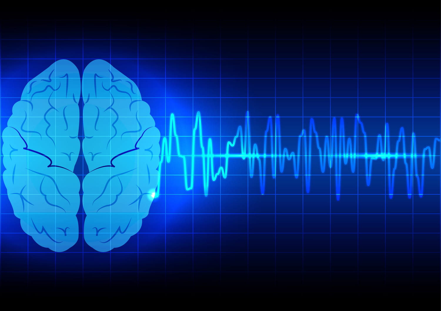 Des neuroscientifiques arrivent à enregistrer l’activité cérébrale au moment du décès