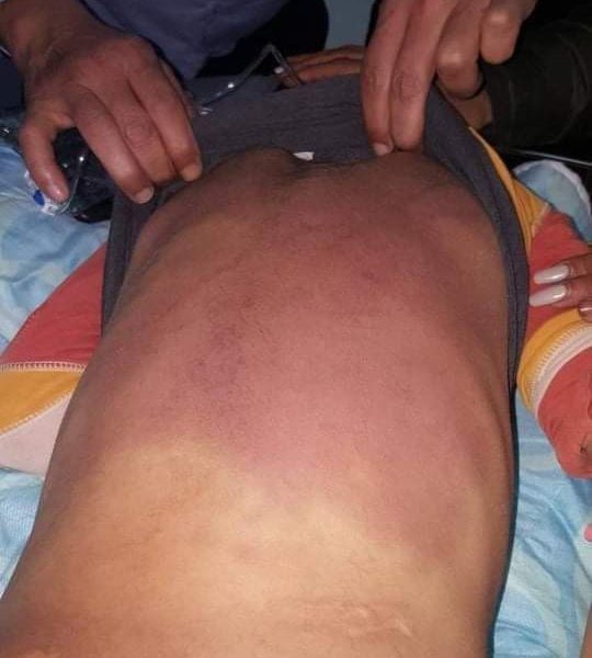 Gafsa: Un parent agresse son fils et lui cause des brûlures sur la peau ! [Photos]