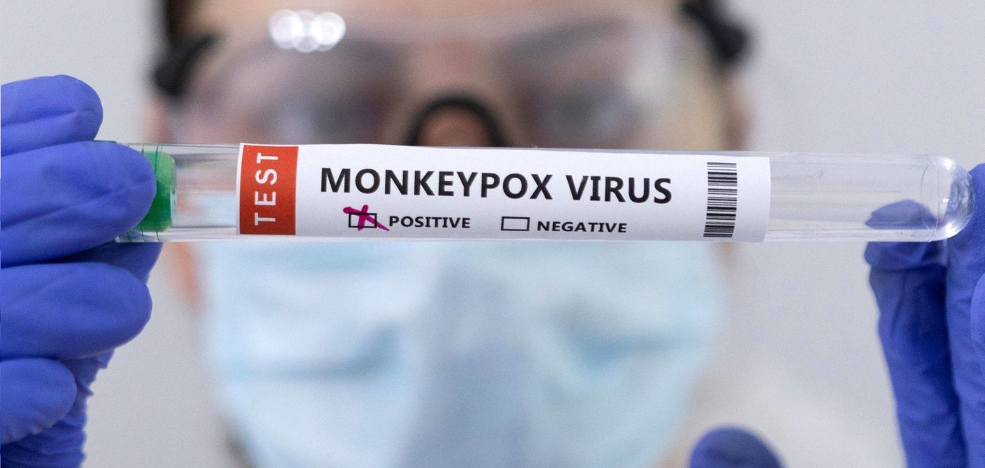 L’Argentine enregistre son premier cas de variole des singes