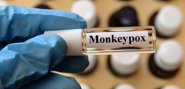 La Turquie enregistre son premier cas de variole des singes