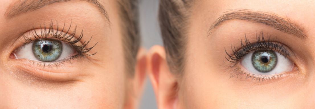 TN Beauté : 4 conseils pour prendre soin du contour des yeux