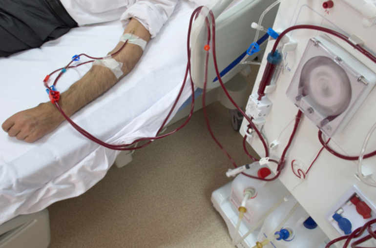Grève des cliniques de dialyse: L’autre version des faits selon Nazih Zghal [Audio]