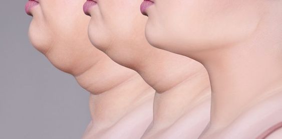 TN Beauté :  des astuces pour perdre le double menton