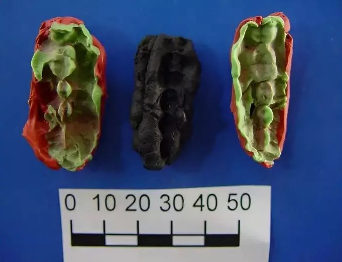 Suède : des ‘chewing-gums’ préhistoriques dévoilent secrets ancestraux