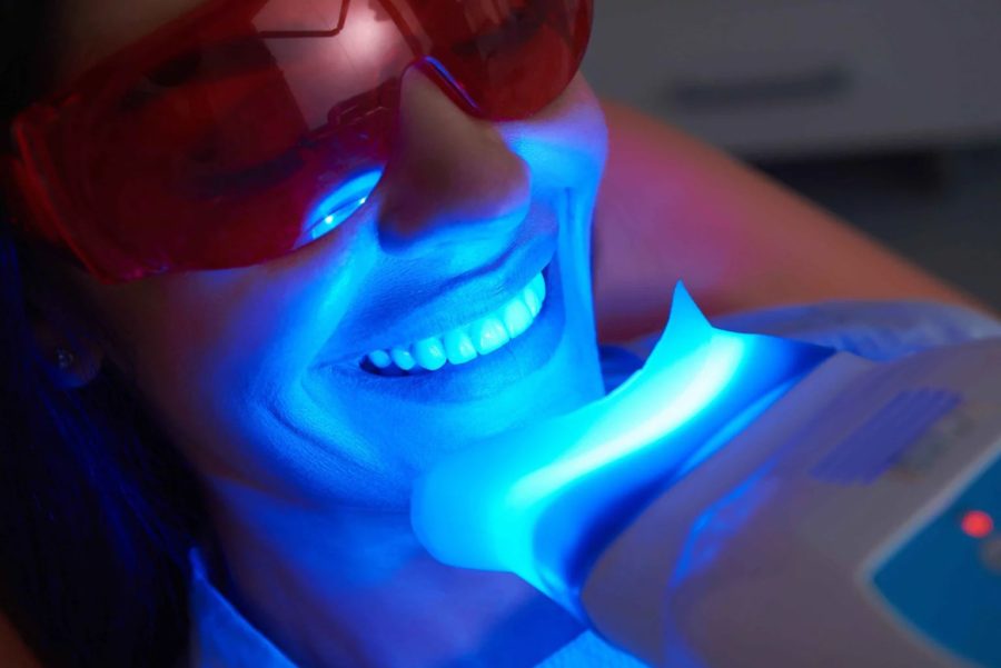 Santé : Les méthodes actuelles de blanchiment des dents : de moins nocives à plus nocives