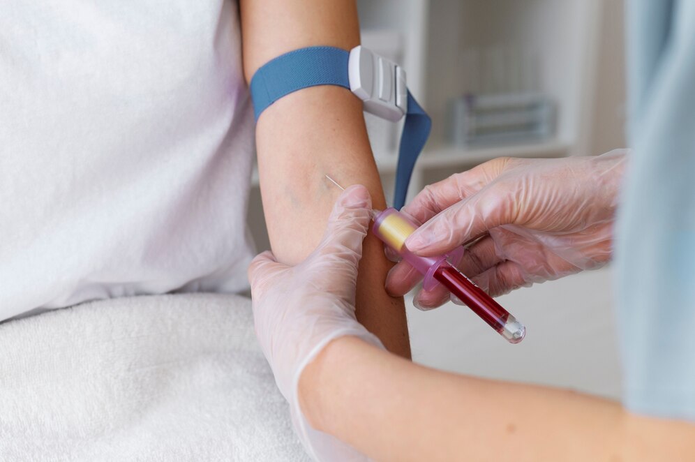 Hémophilie en Tunisie: Plus de 1300 cas recensés, mais combien restent encore dans l’ombre ?