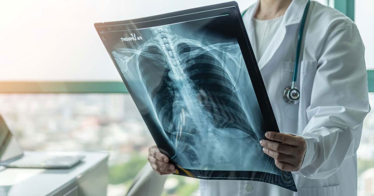 Tuberculose : Experts et vétérinaires appellent à une mobilisation autour de la “One Health”