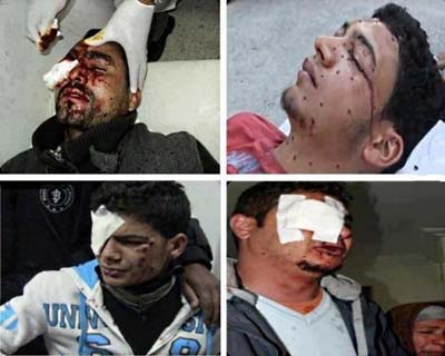 Tunisie – Les blessés par la chevrotine de Siliana portent plainte contre Ali Larayedh